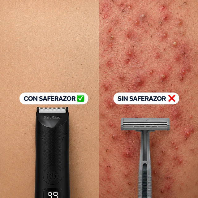 SafeRazor™ – Rasúrate Sin Cortes ni Irritación | Ideal para Zonas Íntimas