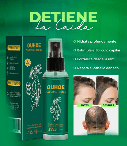 Elhoe Crecimiento Para El Cabello -2x1: Crecimiento y Control de Caída – 100%Natural